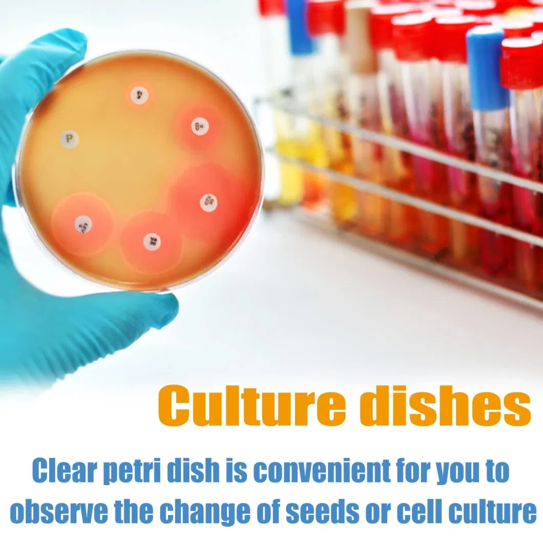 Disposable Plastic 90X15mm Petri Dishes Cell Culture Container 9 Cm Petri Dish