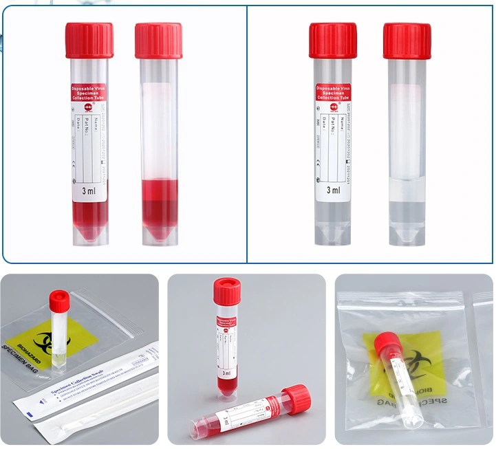 Chengwu Medical 10ml Viral Transportation Medium Tube for PCR Test